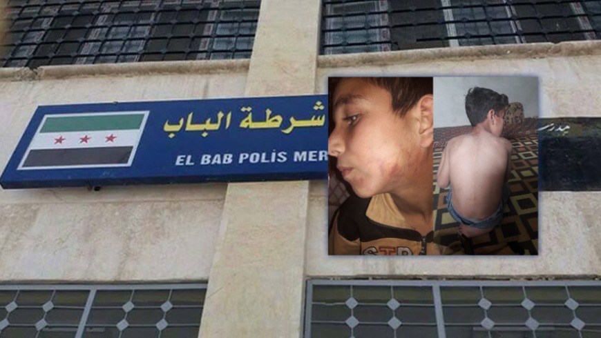 Child and Father Arrested and Tortured in the Bab Police?